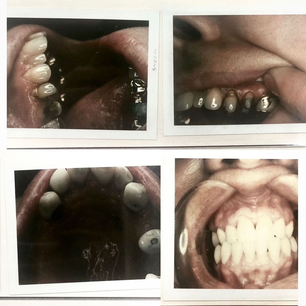 Taking Teeth: Volume 1 (Volume 1) cover