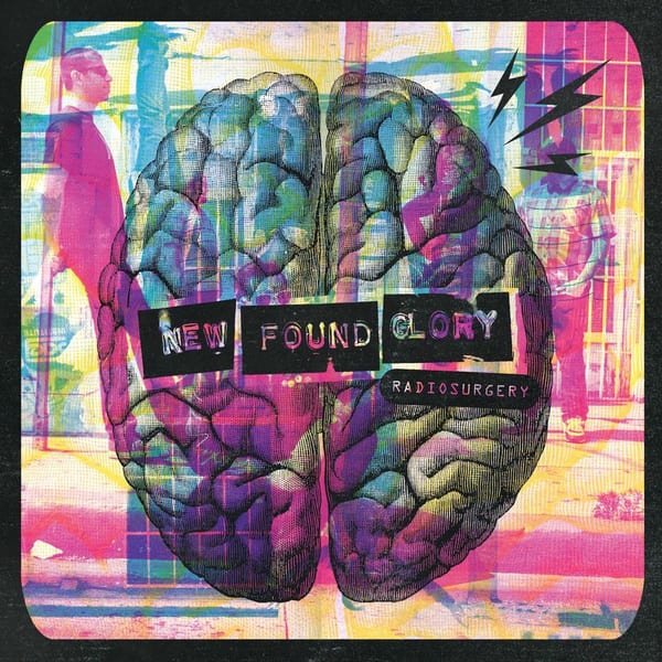 Radiosurgery cover