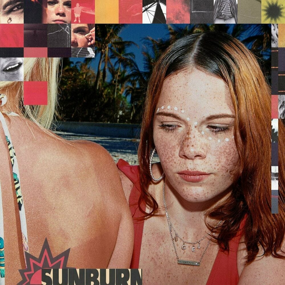 Sunburn cover